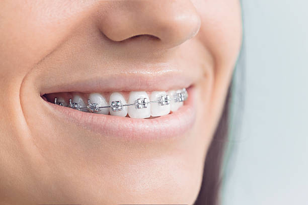 Best Full Mouth Reconstruction  in Valley Falls, KS